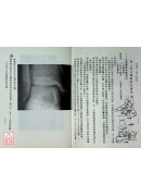 脫臼治療學(上下冊)